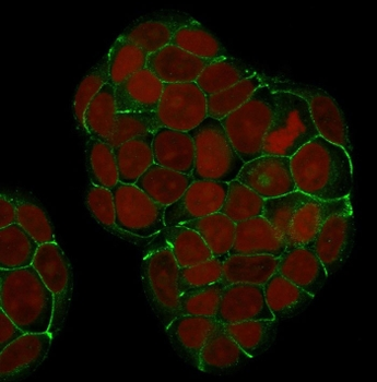 E-Cadherin Antibody / CDH1