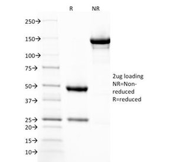 Thrombomodulin Antibody / CD141