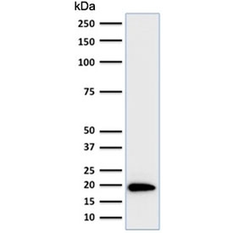 FTL Antibody / Ferritin light chain