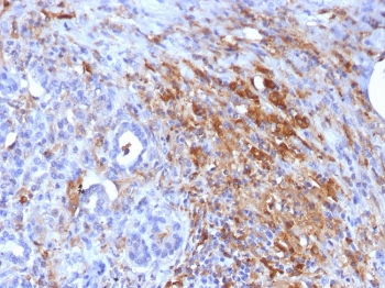 FTL Antibody / Ferritin light chain