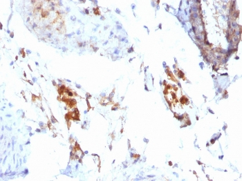 FTL Antibody / Ferritin light chain