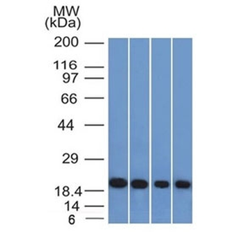 FTL Antibody / Ferritin light chain