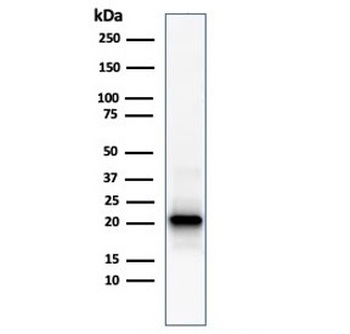 FTL Antibody / Ferritin light chain