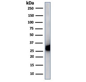 HLA-DP + HLA-DQ + HLA-DR Antibody (MHC II)
