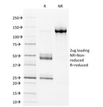 HLA-DP + HLA-DQ + HLA-DR Antibody (MHC II)