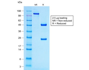 POMC Antibody / ACTH / N-Terminal
