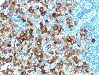 PMEL17 / Melanoma gp100 Antibody