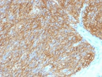 DOG1 Antibody
