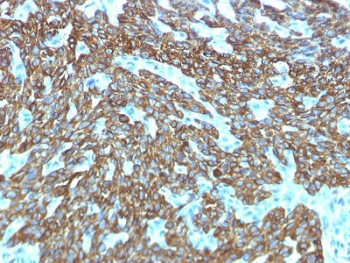Basic Cytokeratin Antibody