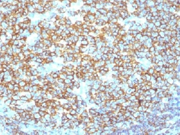 CD20 Antibody