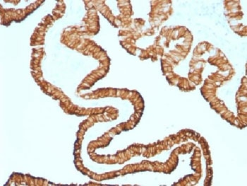 KRT7 Antibody / Cytokeratin 7