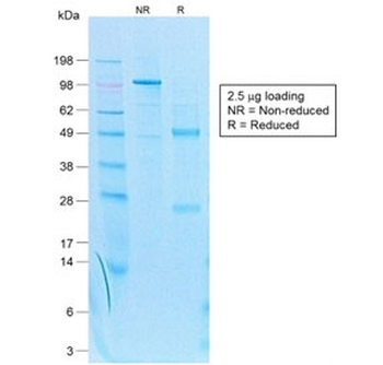 KRT7 Antibody / Cytokeratin 7