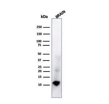 S100B Antibody