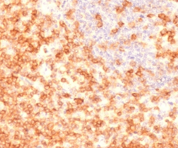 CD27 Antibody