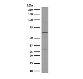 Estrogen Receptor alpha Antibody