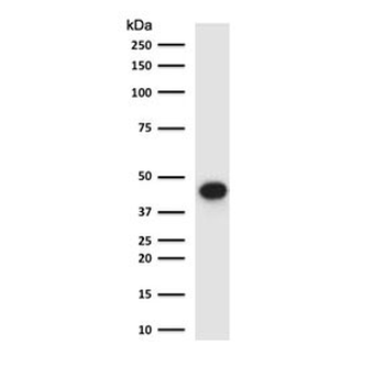EpCAM Antibody / Extracellular domain