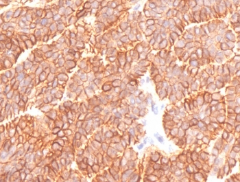 EpCAM Antibody / Extracellular domain
