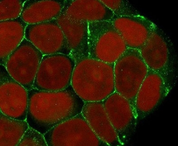 E-Cadherin Antibody / CDH1