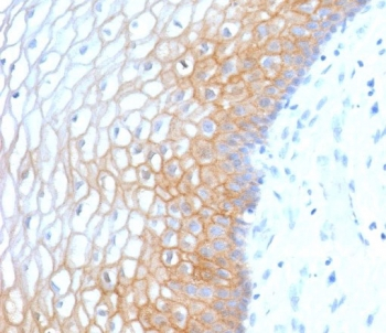 E-Cadherin Antibody / CDH1