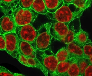 Glypican 3 Antibody / GPC3