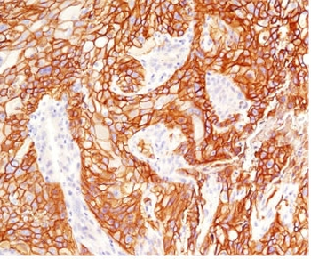 EGFR Antibody / Epidermal Growth Factor Receptor