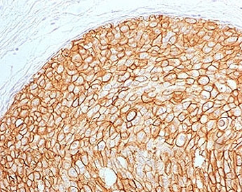 ErbB2 Antibody / HER2