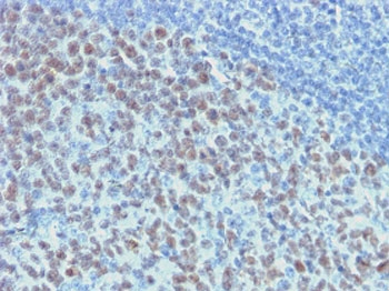 Bcl6 Antibody