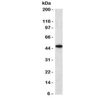 Cytokeratin 18 Antibody