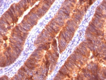 MUC1 Antibody / Mucin-1