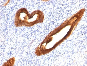 MUC1 Antibody / Mucin-1