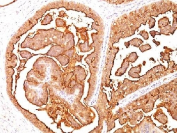 MUC1 Antibody / Mucin-1