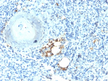 TRAcP Antibody / TRAP / ACP5