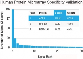 TRAcP Antibody / TRAP / ACP5