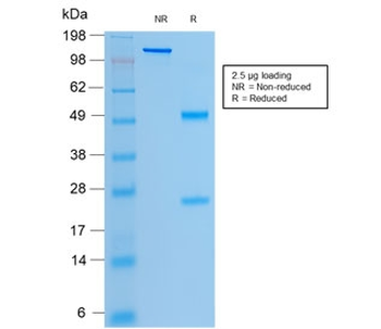 CFTR Antibody / Cystic Fibrosis Transmembrane Regulator