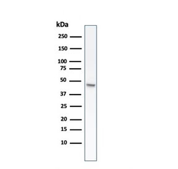 KRT8 Antibody / Cytokeratin 8