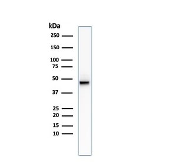 KRT8 Antibody / Cytokeratin 8