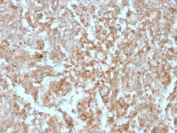 DOG1 Antibody / TMEM16A / ANO1