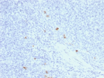 Human IgG4 Antibody