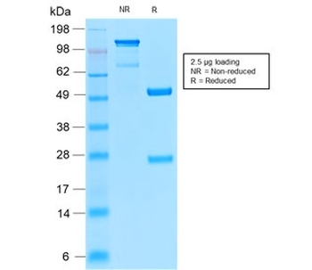CD52 Antibody