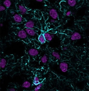 GFAP Antibody / Glial Fibrillary Acidic Protein