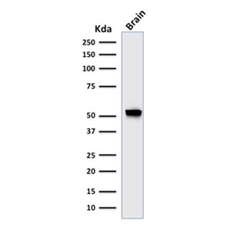 GFAP Antibody / Glial Fibrillary Acidic Protein