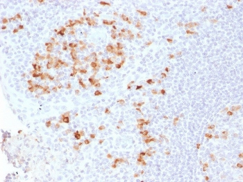 Kappa Light Chain Antibody