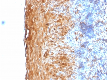 Involucrin Antibody