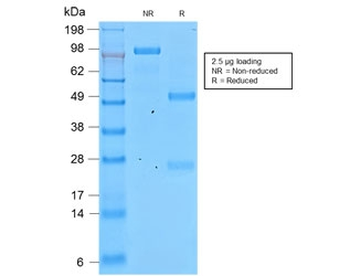 Involucrin Antibody