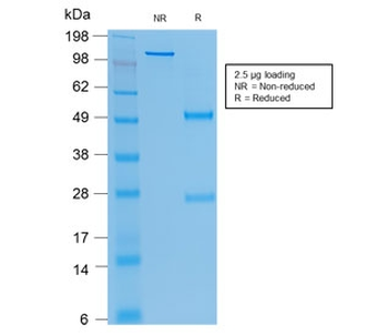 CEA Antibody / Carcinoembryonic Antigen