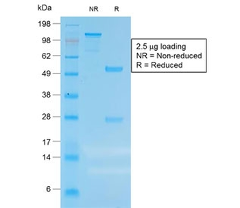 CEA Antibody / Carcinoembryonic Antigen