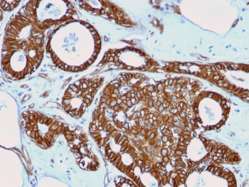 Beta Catenin Antibody