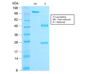 Beta Catenin Antibody