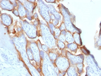 HCG-beta Antibody