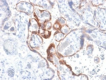 HCG-beta Antibody